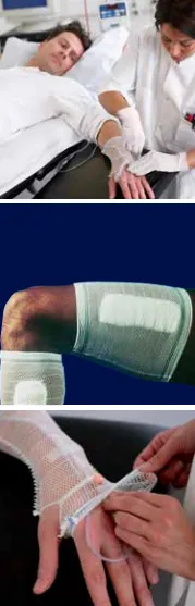 CareFix elastický síťový obvaz Tube (ruka/noha), velikost XL