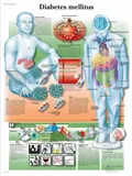 Anatomická tabulka Diabetes  50 x 67 cm