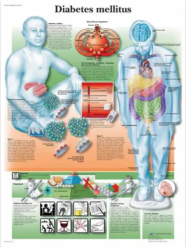 Anatomická tabulka Diabetes  50 x 67 cm