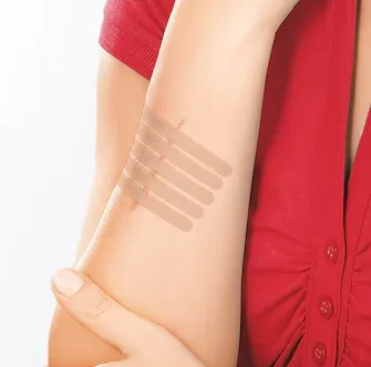 Leukoplast® wound closure strip, 3mm x 75mm (50ks v balení)