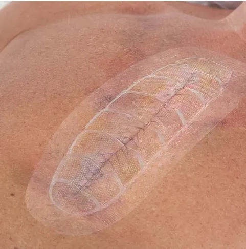 Leukomed® Control, 8cm x 15cm (10ks v balení)