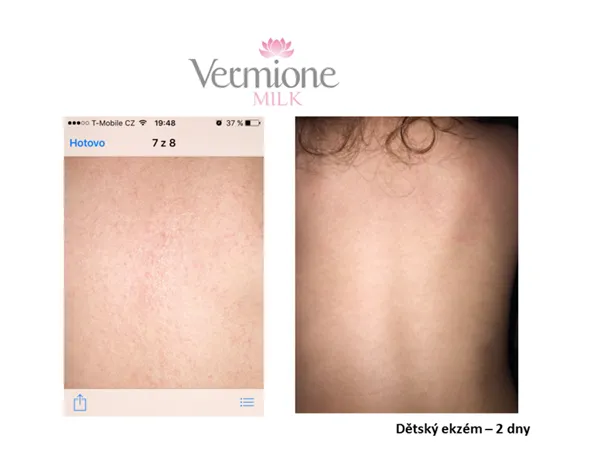 Vermione MILK regenerační, vyživující mléko