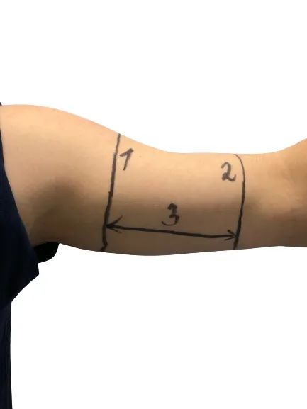 Fixační návlek vel. XL na dia senzor dětský neoprenový růžový