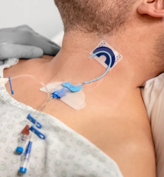 FlexGRIP CVC 4,5-9 Fr s podkovou, Hydrocolloid (pro centrální katétry)